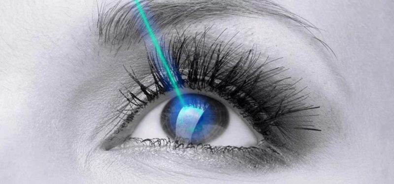 Liệu pháp Laser mắt